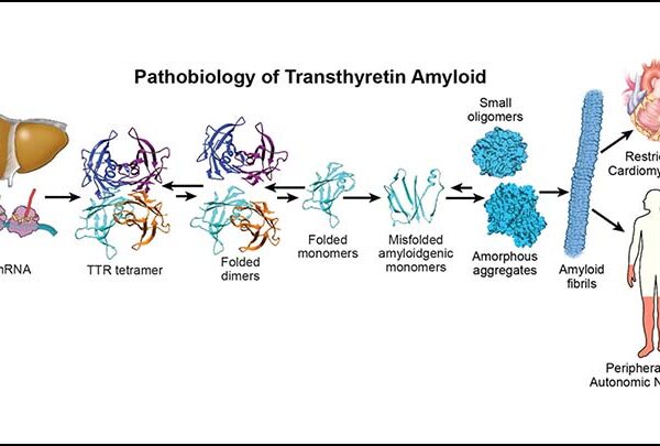 The Association between Preoperative Tamsulosin Use and Intraoperative Hypotension